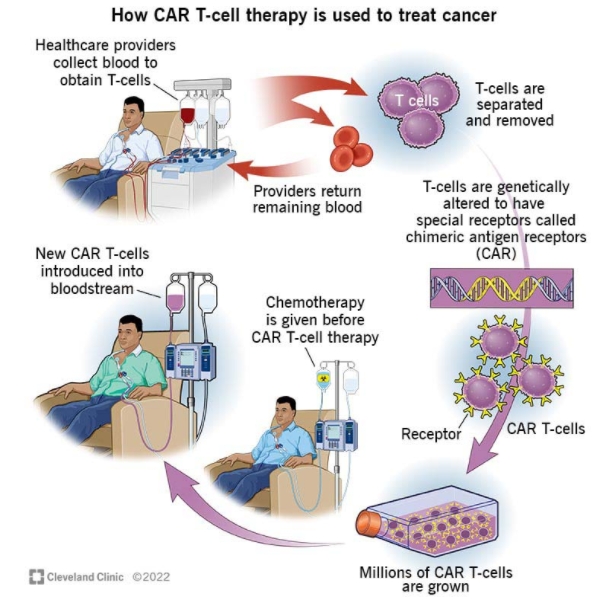 肿瘤特效药(CAR-T)120万一针,这到底是在救命还是致贫